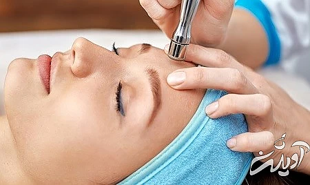 میکرونیدلینگ کلاژن تراپی تاثیر کلاژن تراپی بر جوانسازی صورت, جوانسازی صورت با کلاژن تراپی, کلاژن تراپی